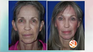 Look up to 20 years younger without plastic surgery