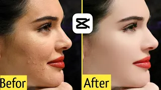 Smooth skin video editing 🙂|| how to remove pimple