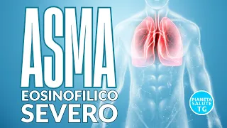 Mepolizumab: Rivoluzione nel Trattamento dell'Asma Grave e Altre Patologie Eosinofilo Correlate