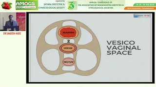 SOGS -  AVASCULAR SPACES IN PELVIS DR SANDESH KADE .   AMOGS 2019