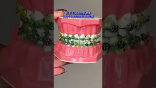 HOW TO FLOSS AND BRUSH YOUR TEETH WITH BRACES / BRACES JOURNEY TIPS 🦷 🪥