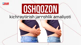 Oshqozon kichraytirish jarrohlik amaliyoti | Olam Klinika