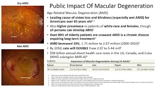 Diabetic Retinopathy, Age-Related Macular Degeneration, and Access to Eye Care