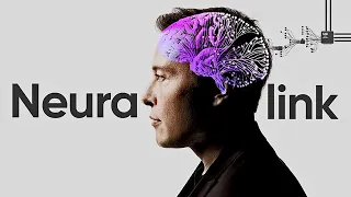 YA SE HA IMPLANTADO EL PRIMER CHIP CEREBRAL DE LA EMPRESA DE ELON MUSK - ¿Telepatía en breves?