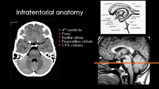 CT brain & CVS   BRC 5   Nov 2013   Dr Mamdouh Mahfouz In Arabic