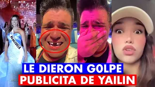 VENEZOLANA QUE G0LPE0 PUBLICISTA DE YAILIN LA MAS VIRAL ROMPE EL SILENCIO