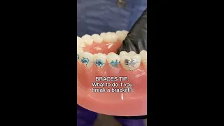 Broken Braces? Here's What To Do... 🦷 #shorts