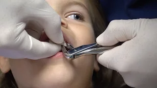 Sunshine gets her tooth pulled by the dentist with Novocain. Is she afraid?