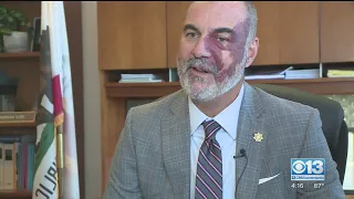 Placer County DA Talks Going Through Life With Port-Wine Stain Birthmark