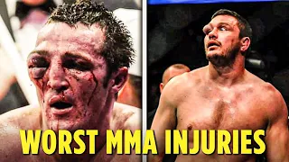 Worst Injuries In UFC History