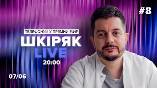 #8 Середа 07/06 о 20:00 Шкіряк LIVE. Телефонуй у прямий ефір. Все про нейрохіругію і онкологію.