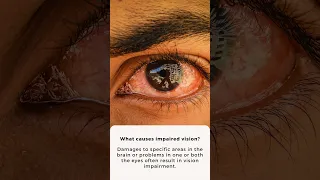 What is a visual disturbance? | What causes impaired vision? | Apollo Hospitals