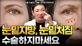 눈밑지방 없애는 법! 수술 전 다시 생각해보세요. 이런분들은 불만족할 확률이 높습니다.