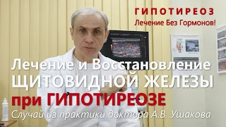 Гипотиреоз: Лечение без гормонов Щитовидной железы. Пример случая из практики || Доктор Ушаков