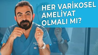 Her Varikoseli Olan Ameliyat Olmalı Mıdır?