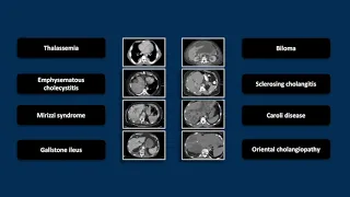 Biliary Emergencies | Interesting Radiology Cases