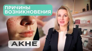 ❤️ПРИЧИНЫ ВОЗНИКНОВЕНИЕ АКНЕ И СПОСОБЫ ЛЕЧЕНИЯ!