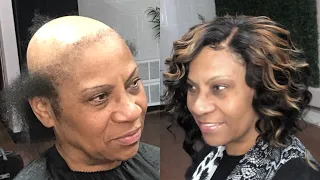 PROTECTIVE QUICK WEAVE CURLY BOB GLUELESS CLOSURE | SEVERE ALOPECIA AREATA TRANSFORMATION