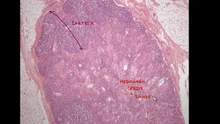 Lymph node Histology - lymphatic system part 2