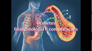 Diabetes : Fisiopatologia e complicações PARTE 01 ( Introdução )