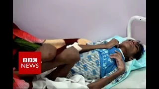 Inside Yemen: The hidden reality - BBC News