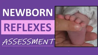 Newborn Reflexes Assessment (Infant) Nursing Pediatric NCLEX Review