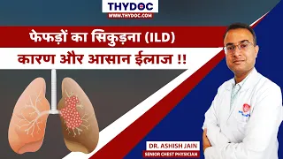 Fefdo Ka Sikudna, Lung Fibrosis Treatment, Lung Fibrosis Kya Hota Hai, Dr. Ashish Jain, Jaipur