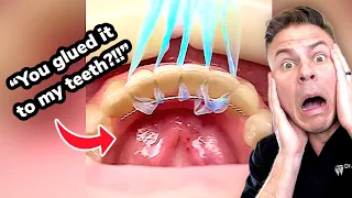 If Your Dentist Glues This To Your Teeth… WATCH OUT!