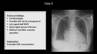 How to Interpret a Chest X-Ray (Lesson 10 - Self Assessment): Part 1