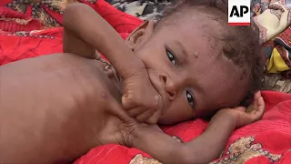 Food aid not reaching families that need it most in Yemen