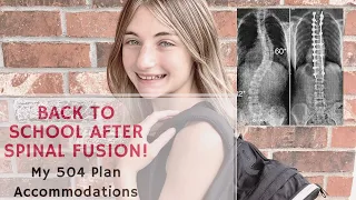 Back to School After Scoliosis Spinal Fusion Surgery