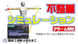 臨床工学技士のたまご～心電図モニタ　不整脈シミュレーション