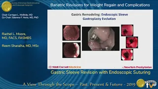 Gastric Sleeve Revision with Endoscopic Suturing