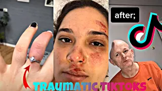 Hey Yo Something Traumatic Happened That Changed My Life Check (Story Time) #73