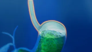 Intestine and stomach treatment medical animation