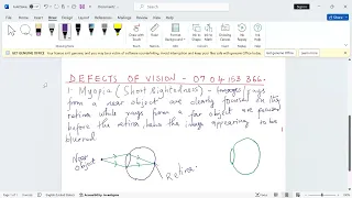 DEFECTS OF THE HUMAN EYE   SHORT SIGHTEDNESS, MYOPIA