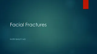 Facial fractures