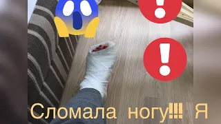 Я сломала ногу!!!