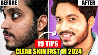 19 Hacks To Get Clear Skin Fast In 2024 | Skin Glow up For Indian Boys & Men