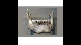 Waterloo Teeth