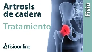 Consejos para la artrosis. Tratamiento y remedios para mejorar el dolor