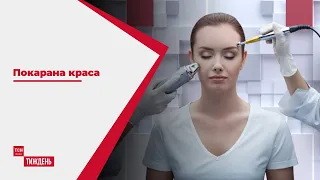 Покарана краса: як похід до косметолога може коштувати кар'єри і майна