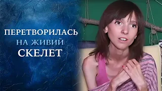 Анорексия: выбор человека или вина близких? (полный выпуск) | Говорить Україна