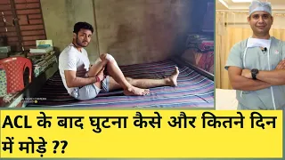 ACL के बाद घर पर कितने दिन में घुटना मोडना चाहिए और कैसे ?? ( Knee bending after ACL surgery )