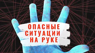 Хиромантия. Опасные ситуации на руке