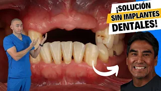 ¿Te faltan dientes y no quieres implantes? Solución asequible $ Dentadura removible