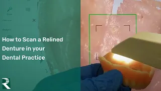 How to Scan a Relined Denture in your Dental Practice