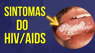 SINTOMAS DO HIV AIDS