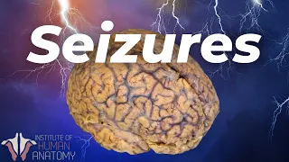 What's Actually Happening During a Seizure