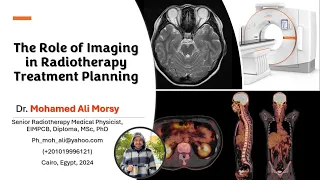 The Role of Imaging in Radiotherapy Treatment Planning